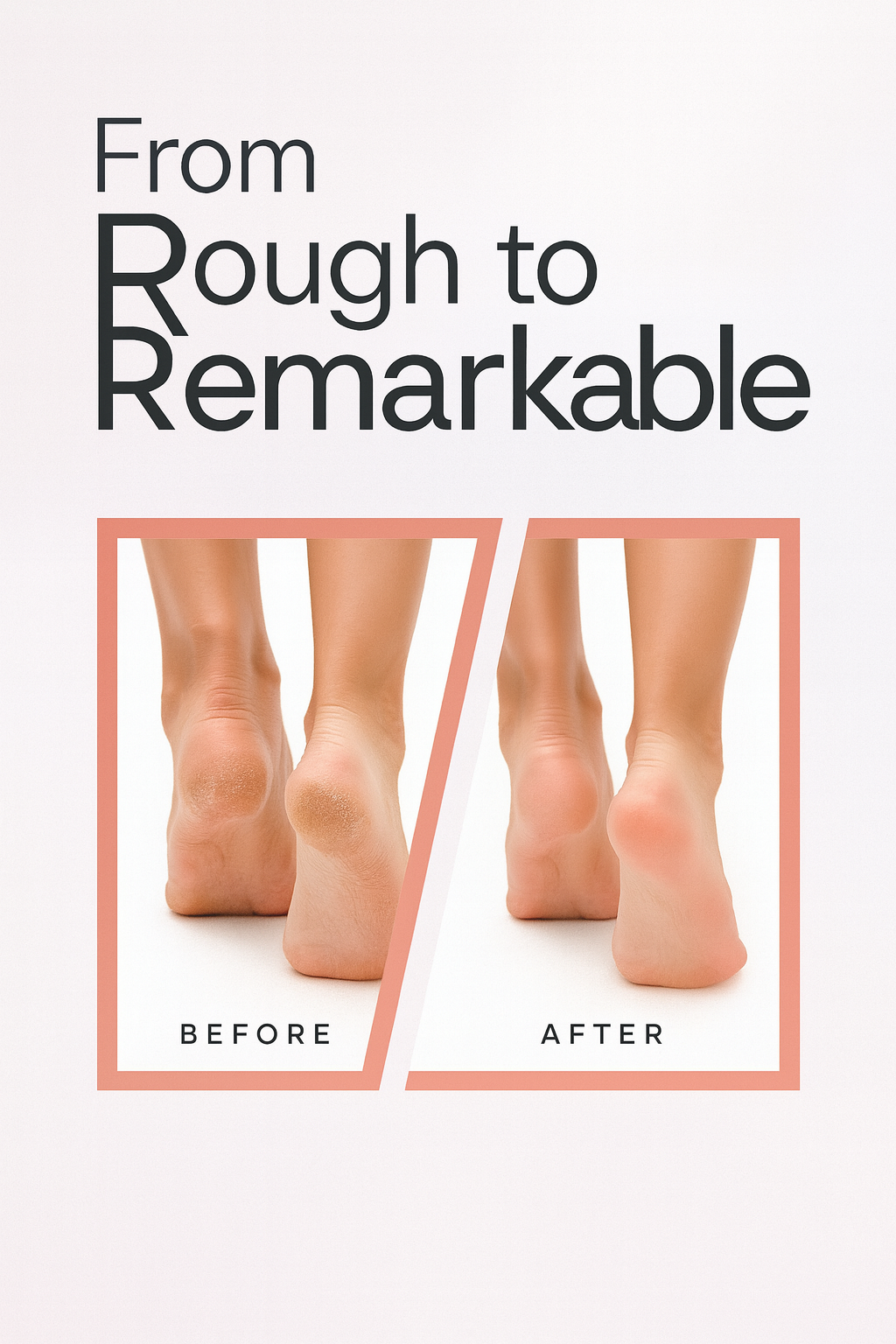 Drop™- Salon-Smooth Heels at Home in 10 Minutes❤️