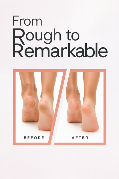 Drop™- Salon-Smooth Heels at Home in 10 Minutes❤️